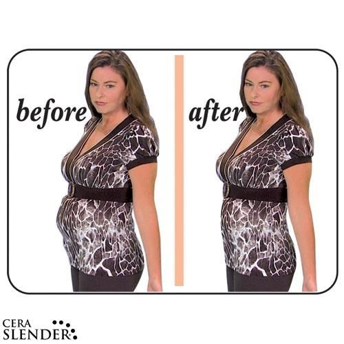CERA SLENDER XL